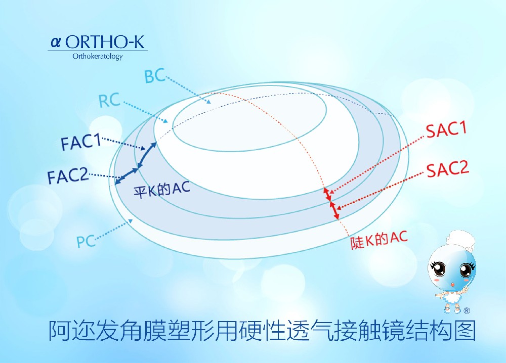 阿迩发角膜塑形镜 注意事项